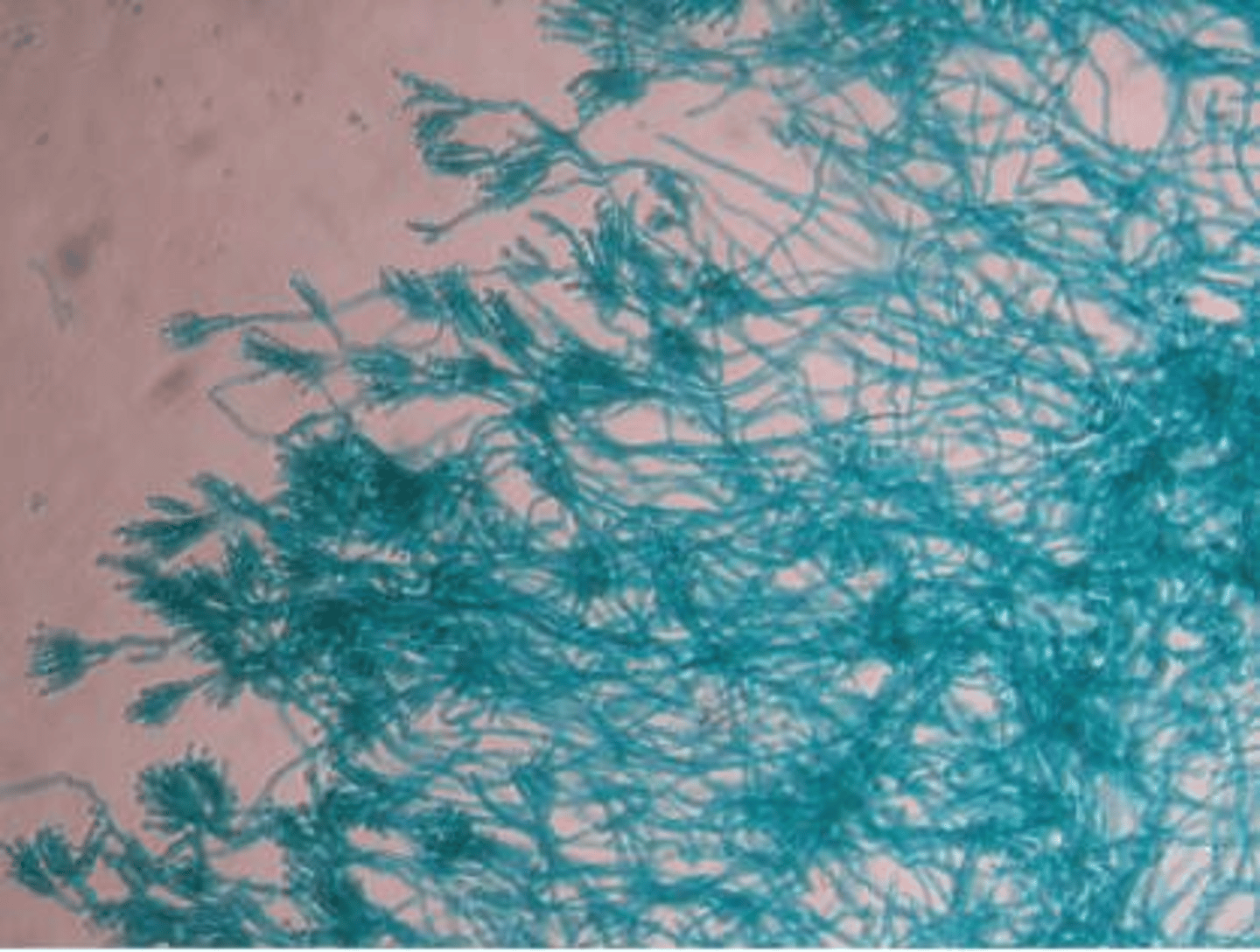 <p>It makes the bacteria glow green.</p>