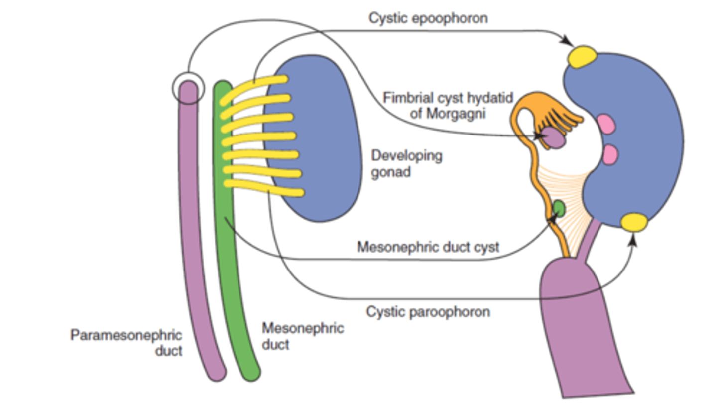<p>Some gene mutations of genes essential for ovarian development and function can result in DSD like:</p><p>- Ovotesticular DSD (both ovarian and testicular tissue present).</p><p>- Excess androgens meaning XX females develop characters associated with male hormones (virilisation) like ambiguous genitalia at birth.</p><p>BUT MOSTLY- The majority are normal females with a minor anomaly, such as cystic remnants of ducts or tubules.</p>