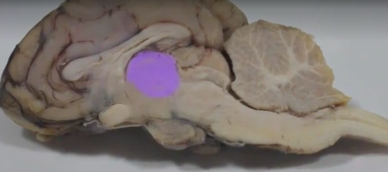What part of the brain is this called 