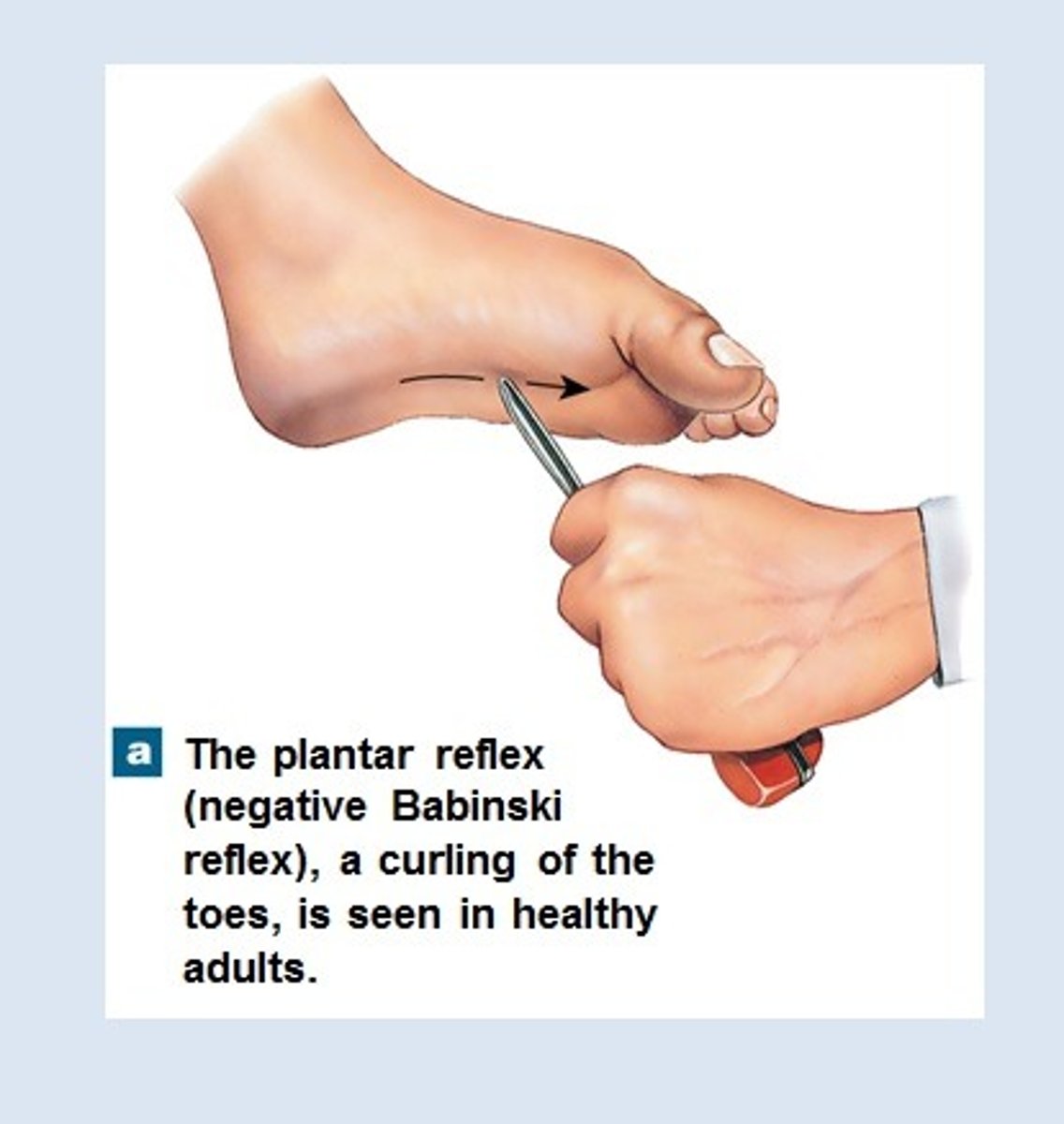 <p>Toes curl inward; normal in adults.</p>