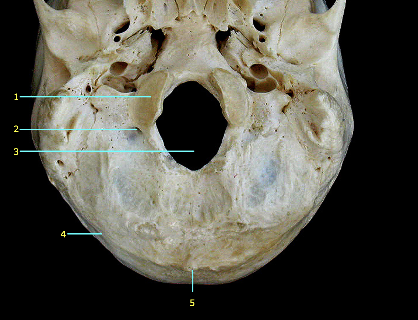 <p>What bone is featured? Identify structures 3 and 5</p>