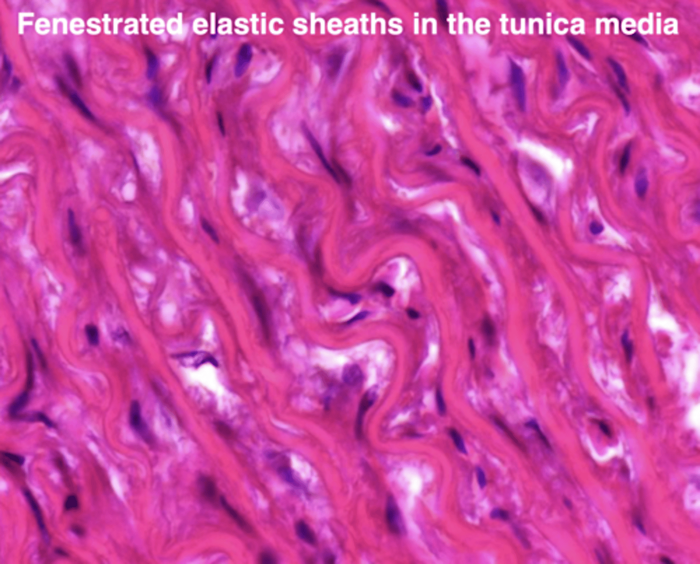 <p>what type of artery is this- elastic, muscular, or arteriole?</p>