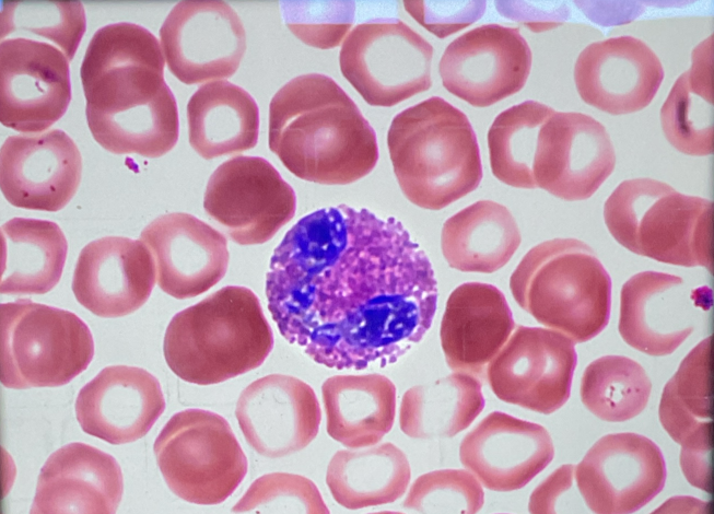 <p>Identify this leukocyte and state what color it stains</p>
