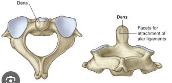 <p>What is the name of this bone?</p>