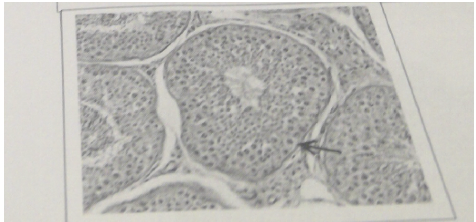 30\. The structure indicated by the arrow