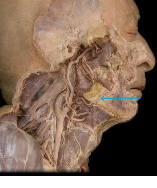 <p>what artery?</p>