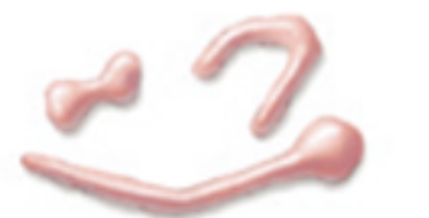 <p>What is the morphology of the bacteria shown?</p>