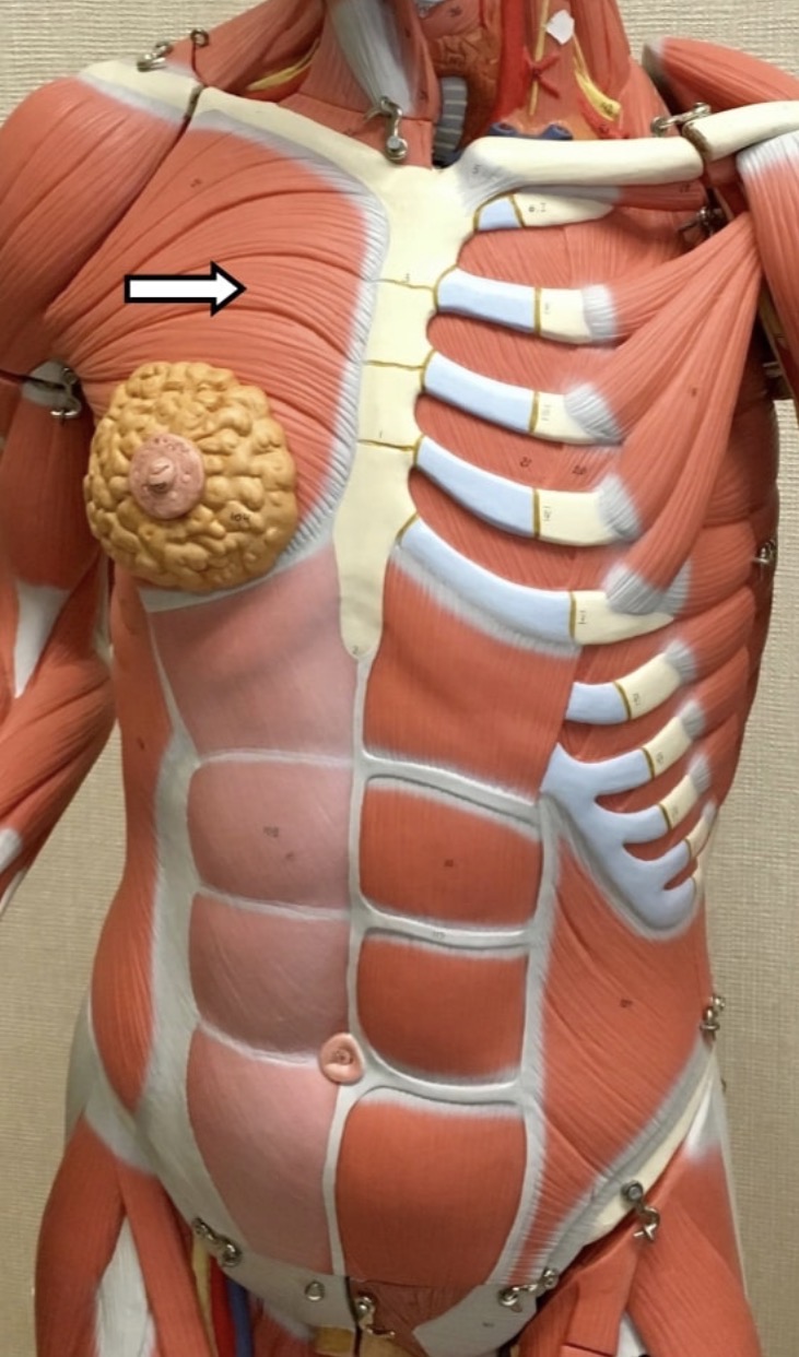 <p><span>Name the muscle labeled with the white arrow below AND name ONE action</span></p>