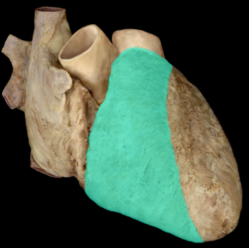 <p>R ventricle</p>