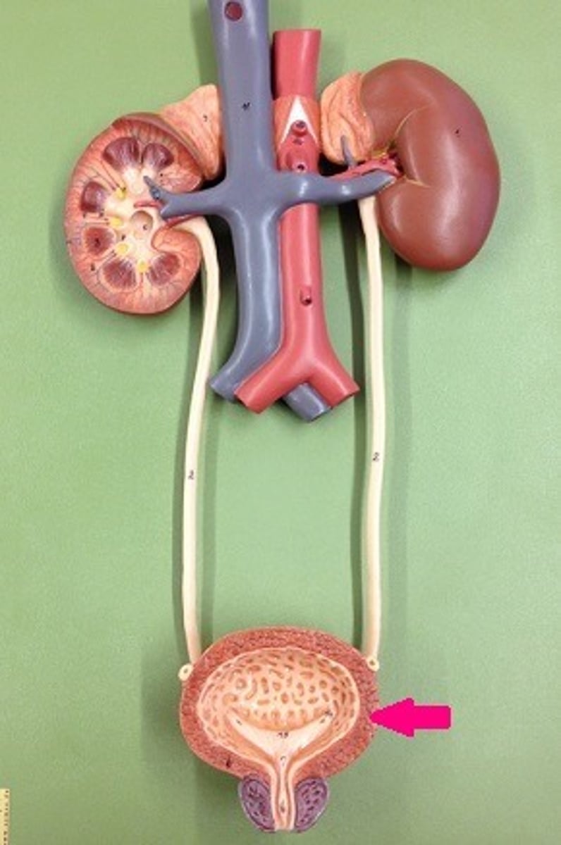 <p>Identify the muscle.</p>