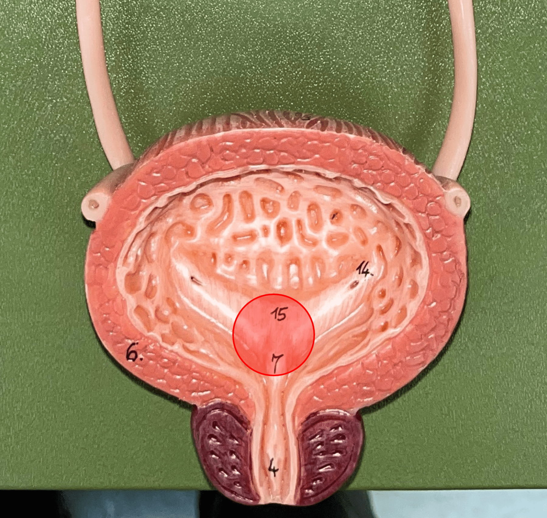 • Part of the urinary bladder.

• The triangle formed by the ureteral openings and internal urethra orifice.