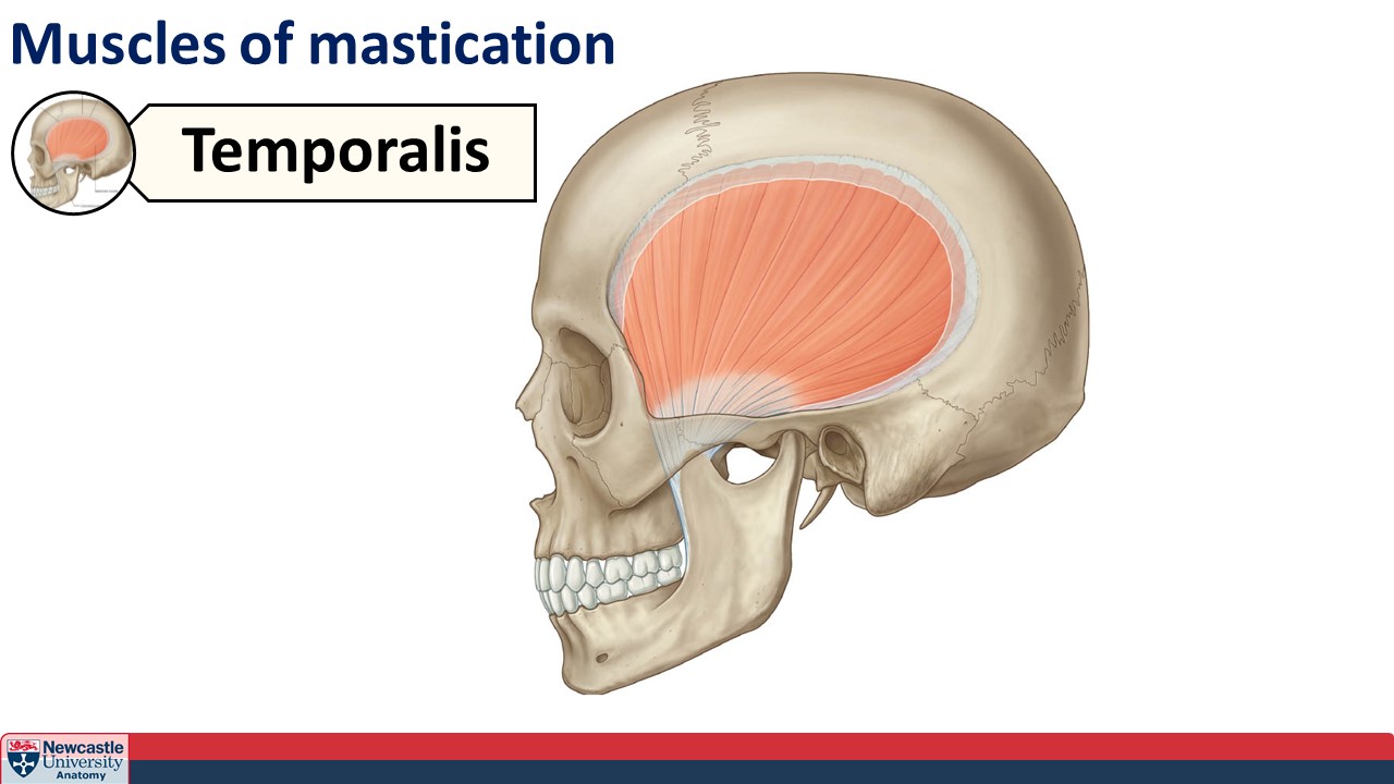 <p>Temporalis muscle</p>