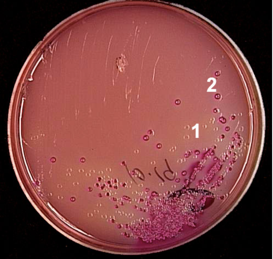 <p>What are the colonies in section 2 showing? </p>