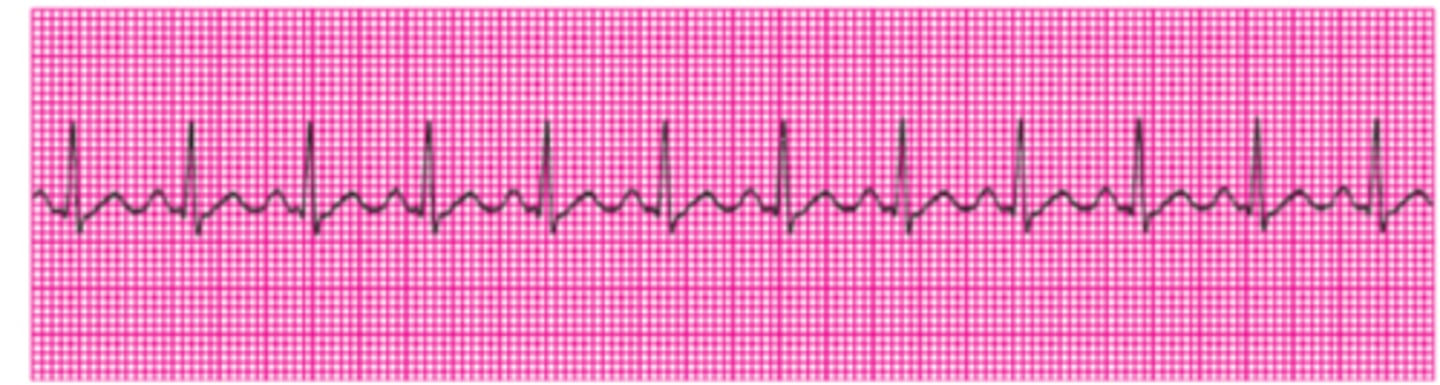 <p>Name this rhythm</p>