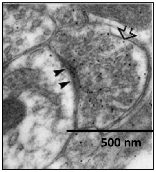 <p>In this electron micrograph, what do the black dots represent?</p>