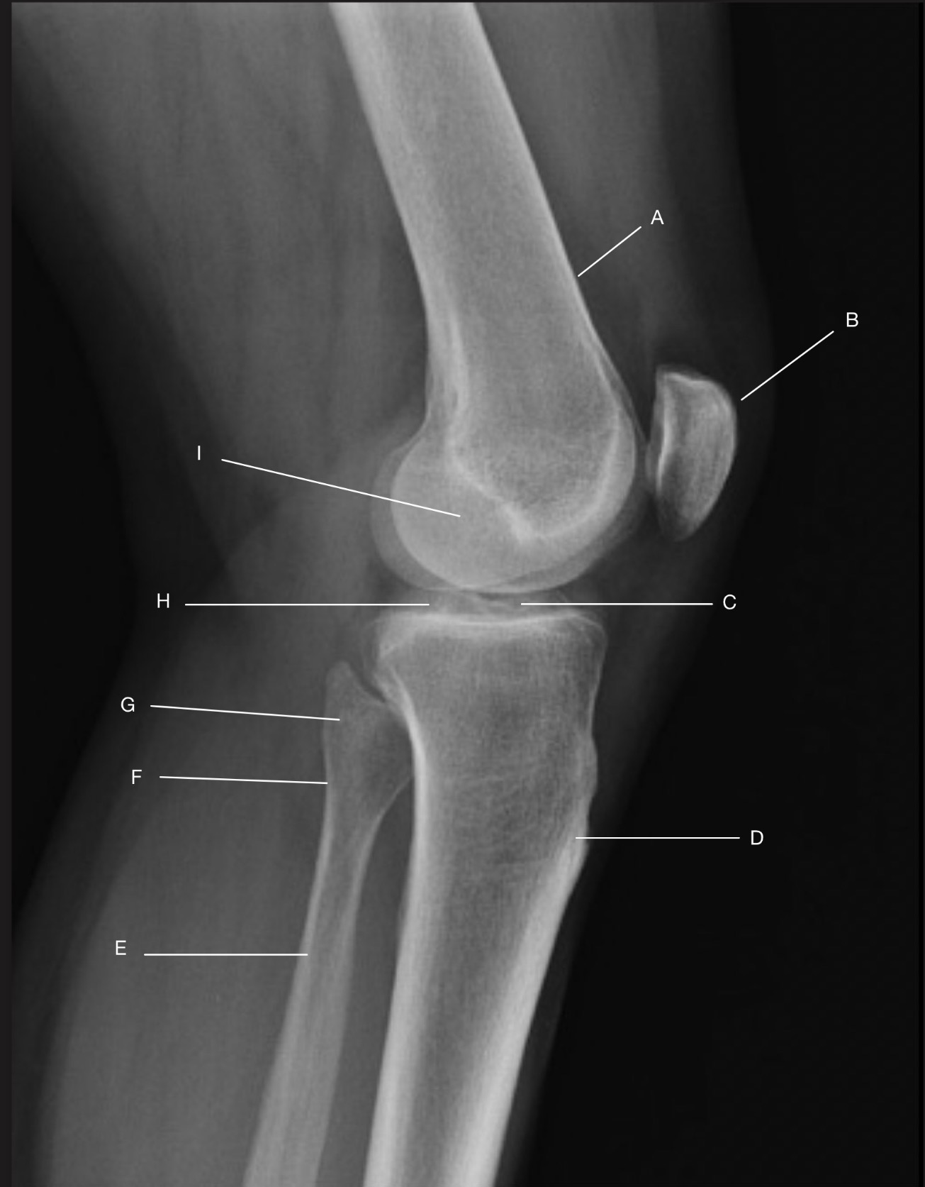 <p>Name the projection.</p><p>Should it be repeated, if so why?</p>
