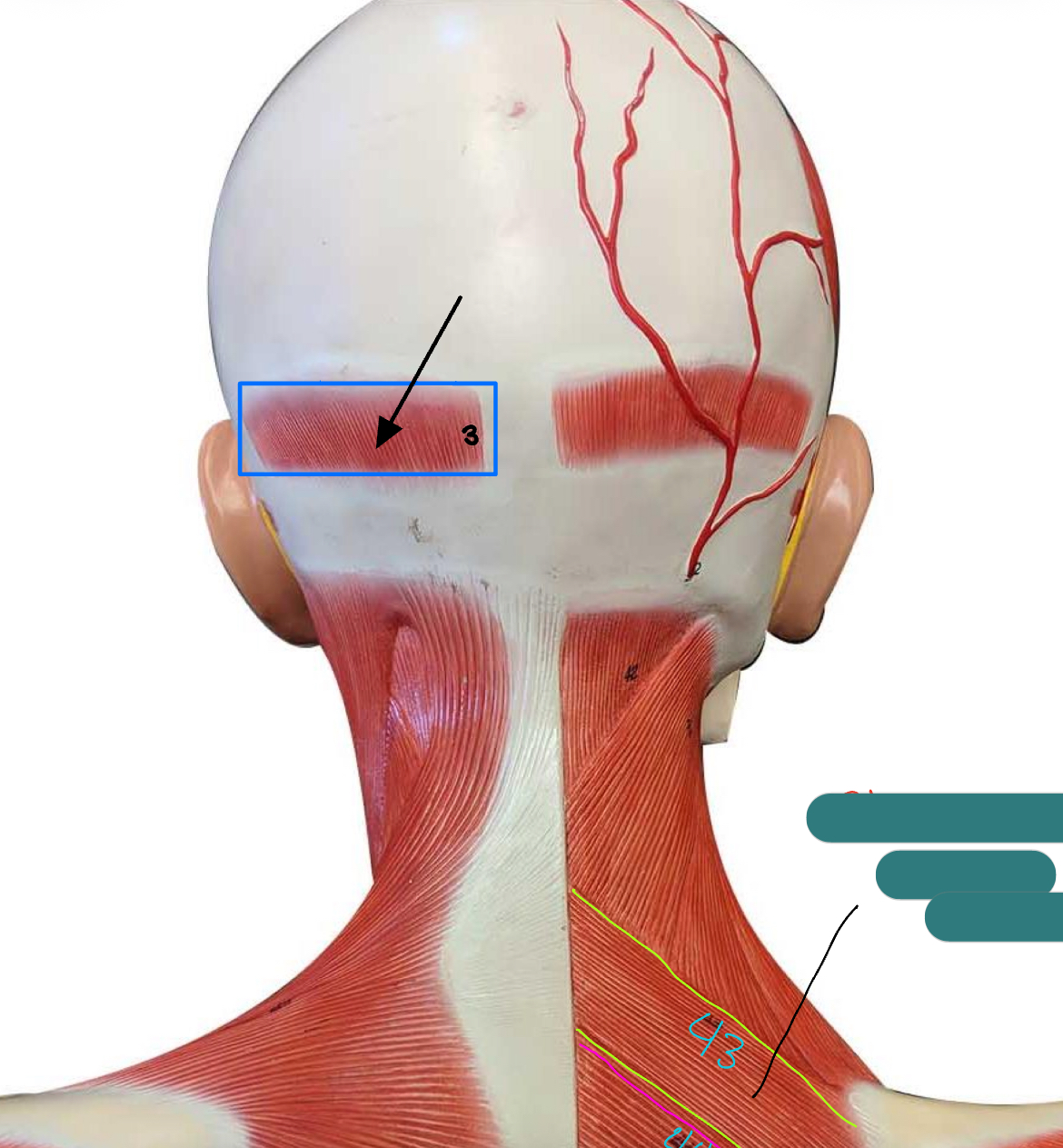 <p>What type of muscle is this (altay model) </p>