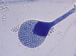 <p><span><strong>Sac-like cell </strong>containing spores&nbsp;</span></p><ul><li><p>form on Sporangio<u>phores</u> + produce Sporagnio<u>spores</u></p></li></ul><p></p>
