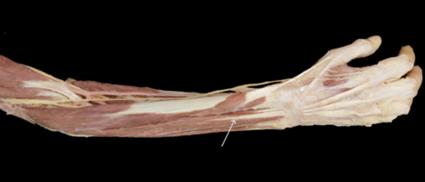 knowt flashcard image