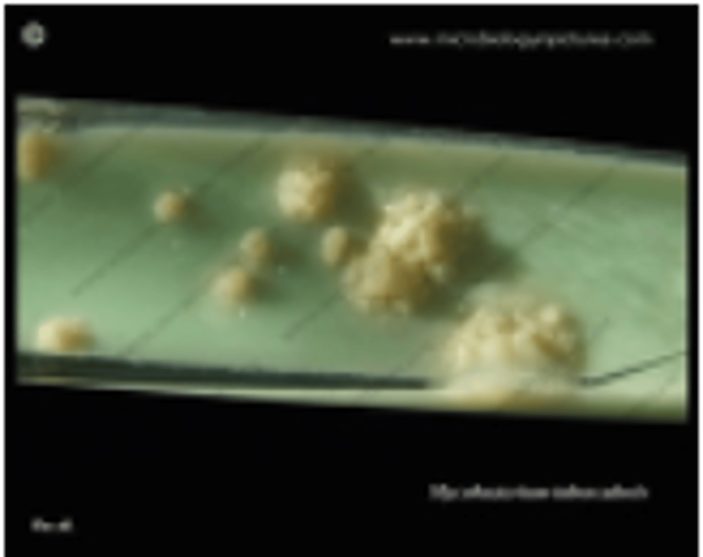 <p>what Mycobacterium spp. is indicated in this image that affects humans</p>