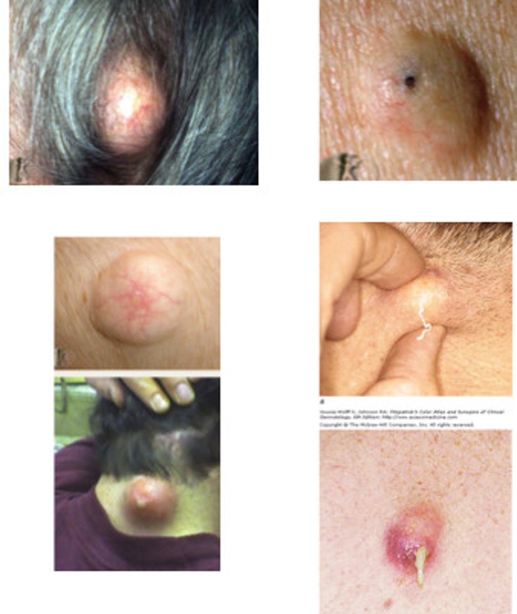 <p>1. skin of head and neck</p>