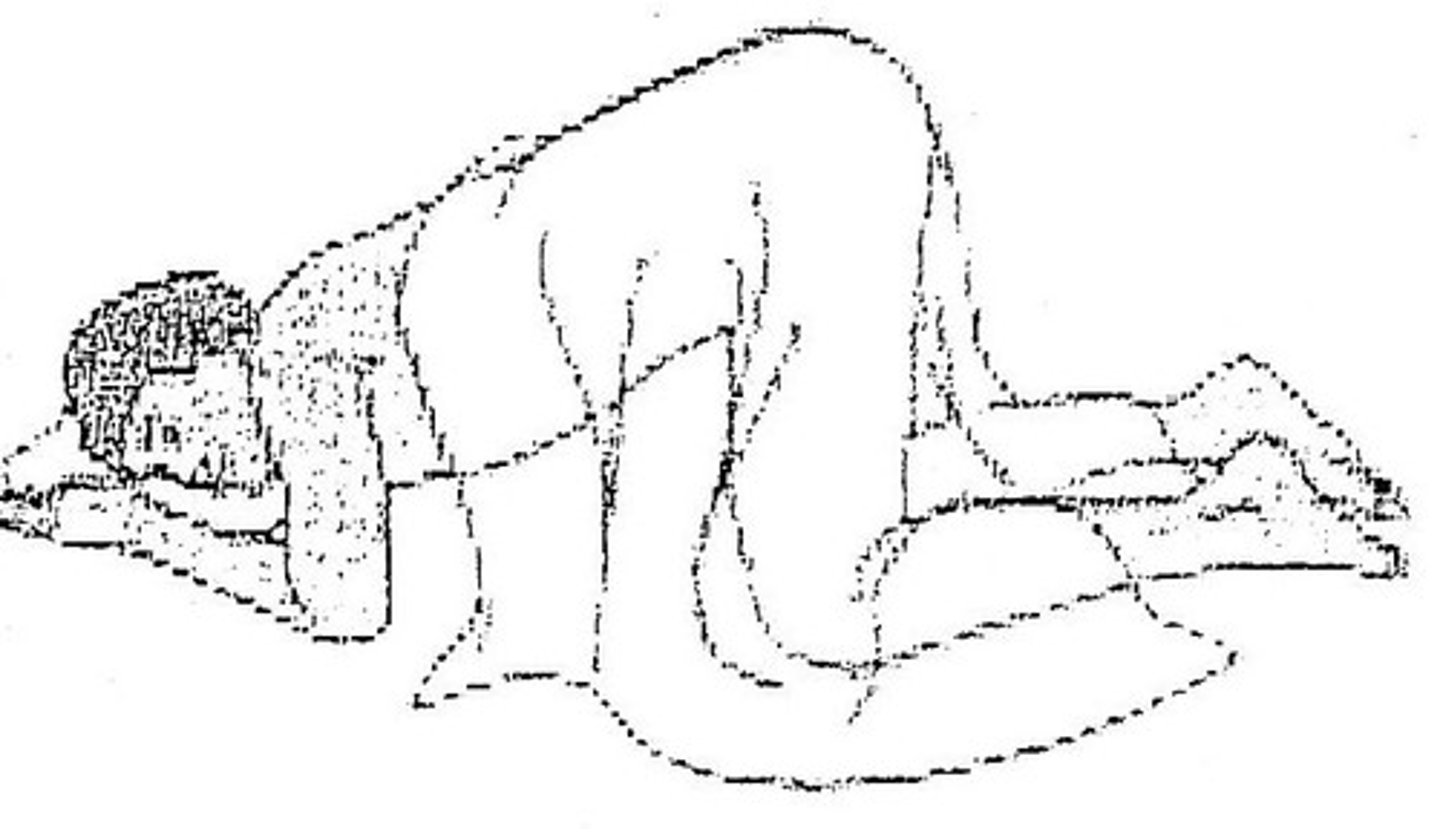 <p>What is a method to treat the Intestines via the Resp-Circ Model that pts can do at home (esp for those with Constipation, Dysmenorrhea, or other Pelvic "Congestion" Issues)?</p>