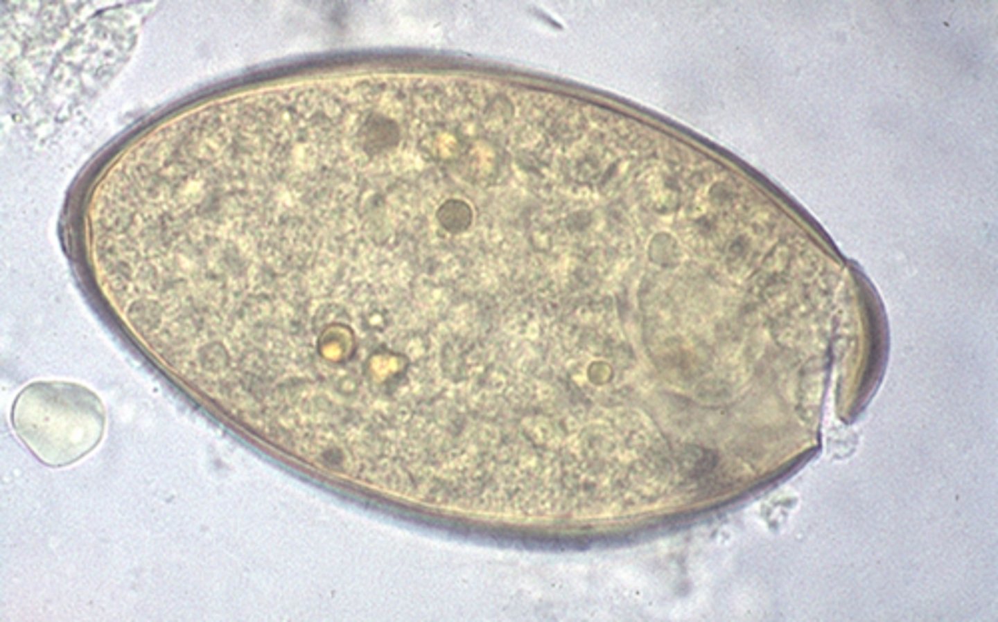 <p>This trematode egg recovered from feces is difficult to distinguish from "Fasciolopsis buski". The parasite is referred to as the SHEEP LIVER FLUKE. Which ovum is present?</p>