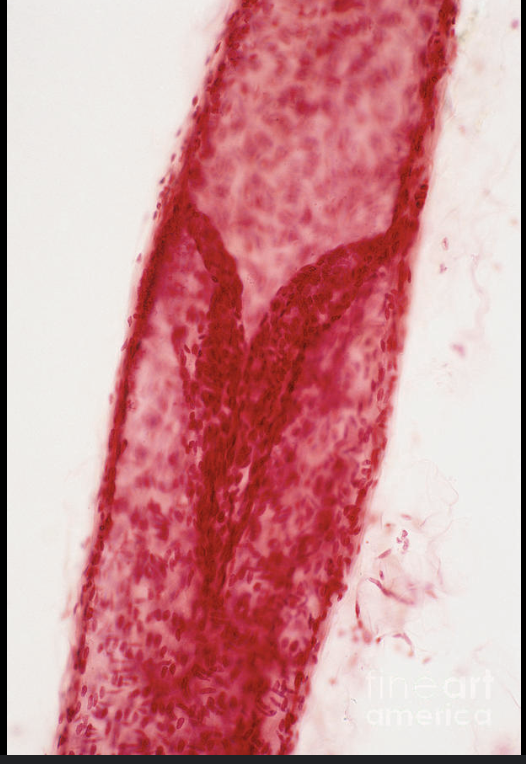 <p>What is this structure of a lymphatic vessel?</p>
