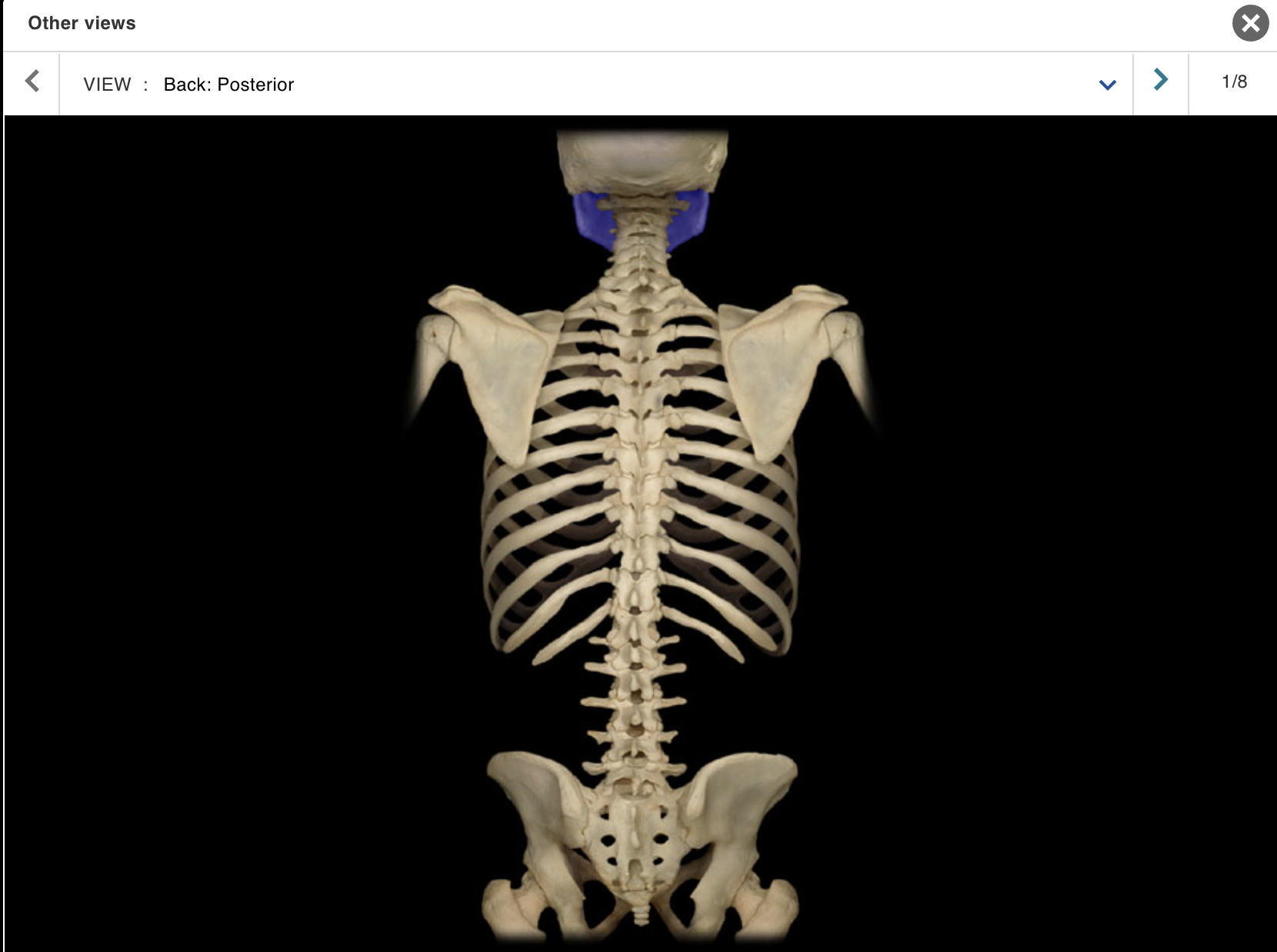 <p>Location:</p><p class="p1">• Skull (anterior)</p><p class="p1">Description:</p><ul><li><p>﻿﻿U-shaped bone</p></li><li><p>﻿﻿Each side consists of body (horizontal) and ramus (vertical) with coronoid and condylar processes</p></li><li><p>﻿﻿Mental protuberance forms point of chin</p></li><li><p>﻿﻿Contains alveoli ("sockets") for teeth</p></li><li><p>Also known as:</p><p class="p1">• "Lower jaw"</p><p class="p1">Comment:</p><p class="p1">• Contributes to temporomandibular joint (TMJ)</p></li></ul><p></p>
