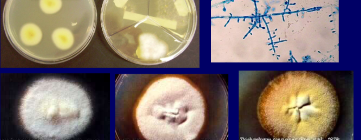 <p>Micro: variable sized thin walled macroconidia, <strong>spiral hyphae, spherical microconidia</strong></p><p>Macro: white-yellow-brown obverse, cream-tan-brown reverse</p>