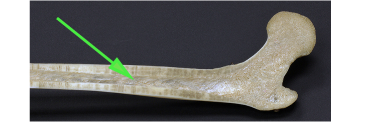 <p>What is the material filling the bone space indicated by the green arrow?</p>