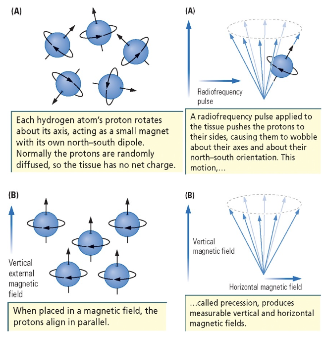 <ol><li><p>each hydrogen atom’s proton rotates about its axis with its own north-south dipole - normally protons are randomly diffused</p></li><li><p>when placed in a magnetic field, protons align in parallel </p></li><li><p>radio frequency pulse applied to tissue pushes protons to their sides, causing them to wobble about their axes</p></li><li><p>this motion is caused precession, which produces measurable vertical and horizontal fields</p></li></ol><p></p>