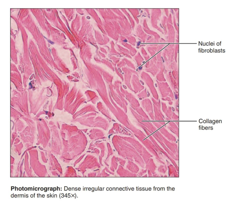 <p>Function: able to withstand tension exerted in many directions; provides structural strength</p><p></p><p>Location: fibrous capsules of organs and joints; dermis of the skin; submucosa of digestive tract</p>