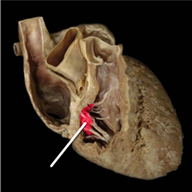 <ul><li><p>right atrioventricular valve/tricuspid valve</p></li><li><p>left atrioventricular valve/mitral valve/bicuspid valve</p></li><li><p>aortic valve</p></li><li><p>semilunar valve</p></li><li><p>pulmonary valve</p></li></ul><p></p>