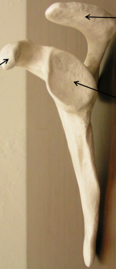 <p>What is the lower right arrow pointing to? </p>