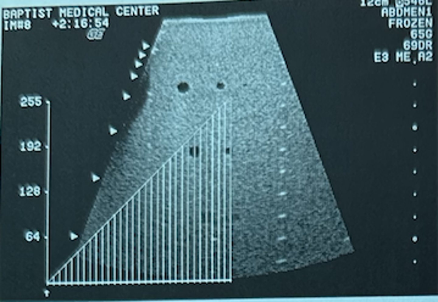<p>The graphic overlay on this phantom image represents a gray-scale assignment curve. What type of curve is being used?</p><p>a. S-curve</p><p>b. Root curve</p><p>c. Linear curve</p><p>d. Light curve</p><p>e. None of the above</p>