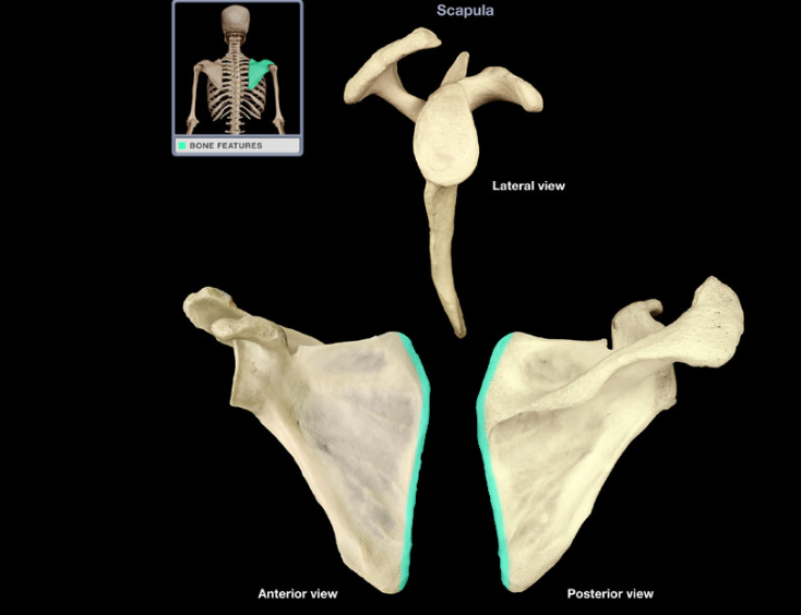 <p>Medial (vertebral) border of scapula</p>