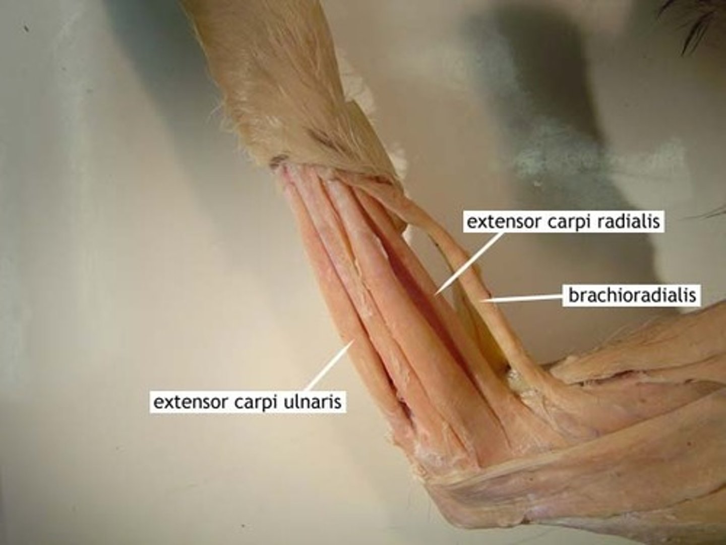 <p>Origin: lateral supracondylar ridge of humerus</p><p>Insertion: base of metacarpal II</p><p>Action: extends and abducts hand</p>