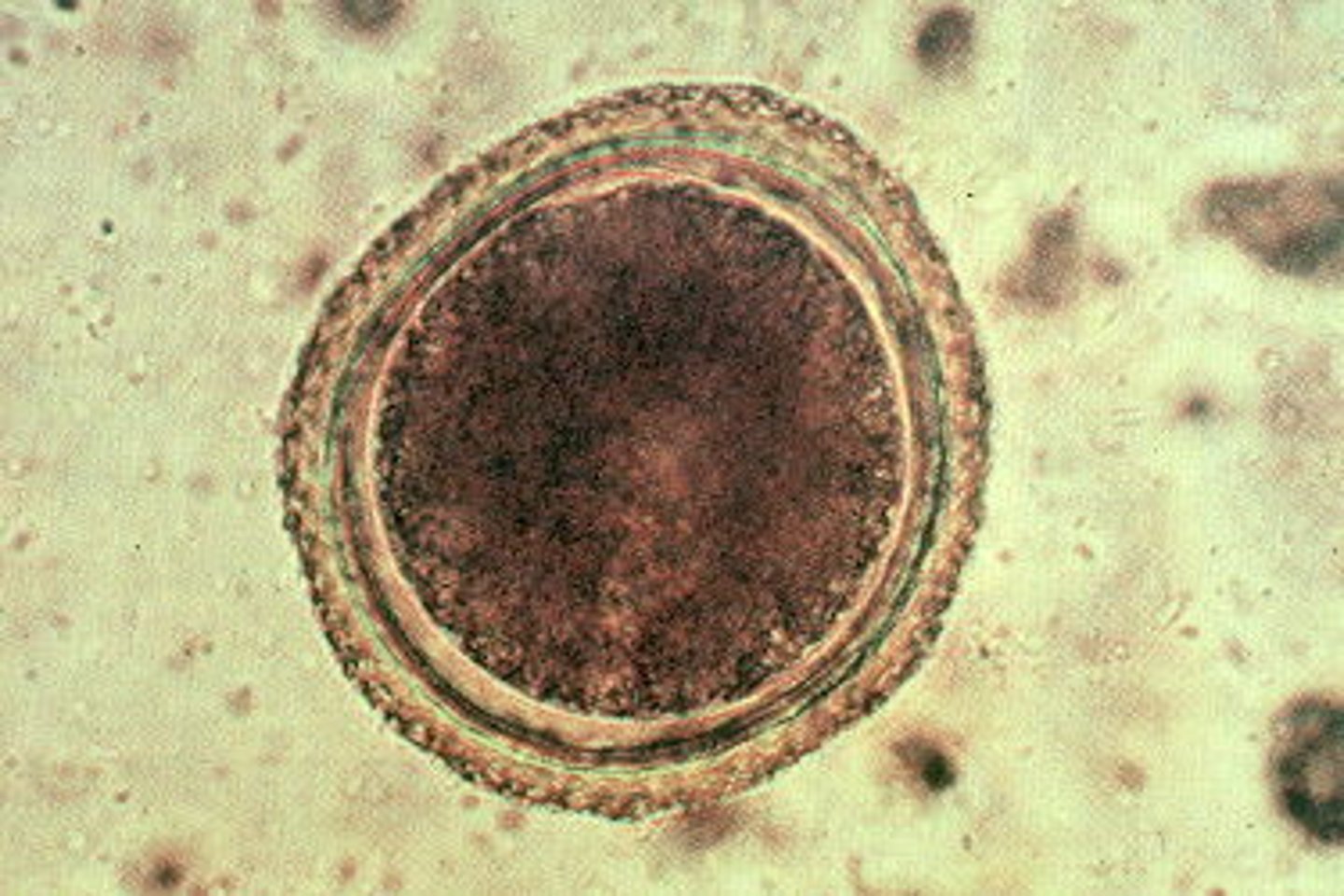 <p>Transplacental transmission of infective larvae in the mother's tissues</p><p>3 multiple choice options</p>