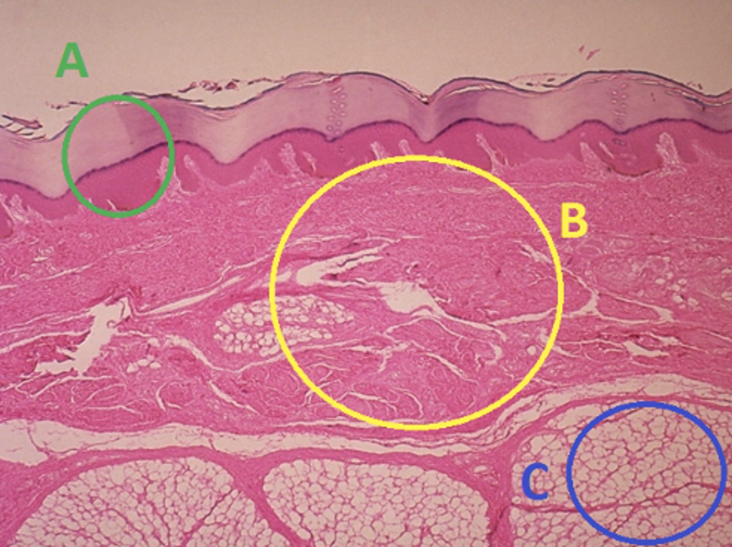 <p>Answer the following questions based on the features indicated in the following image. Which letter indicates the region where skin appendages (sweat glands, sebaceous glands, and hair follicles) have their roots?</p>