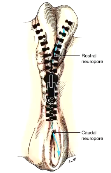 <p>homogenously </p><ul><li><p>The neural tube forms (closing) gradually from the neural plate by "zippering" in caudal and cephalic directions from the cervical region.</p></li><li><p>The last portions of the neural tube to close are the rostral and caudal neuropores.</p><ul><li><p>Rostral Neuropore and Caudal Neuropore</p></li></ul></li></ul><p></p>