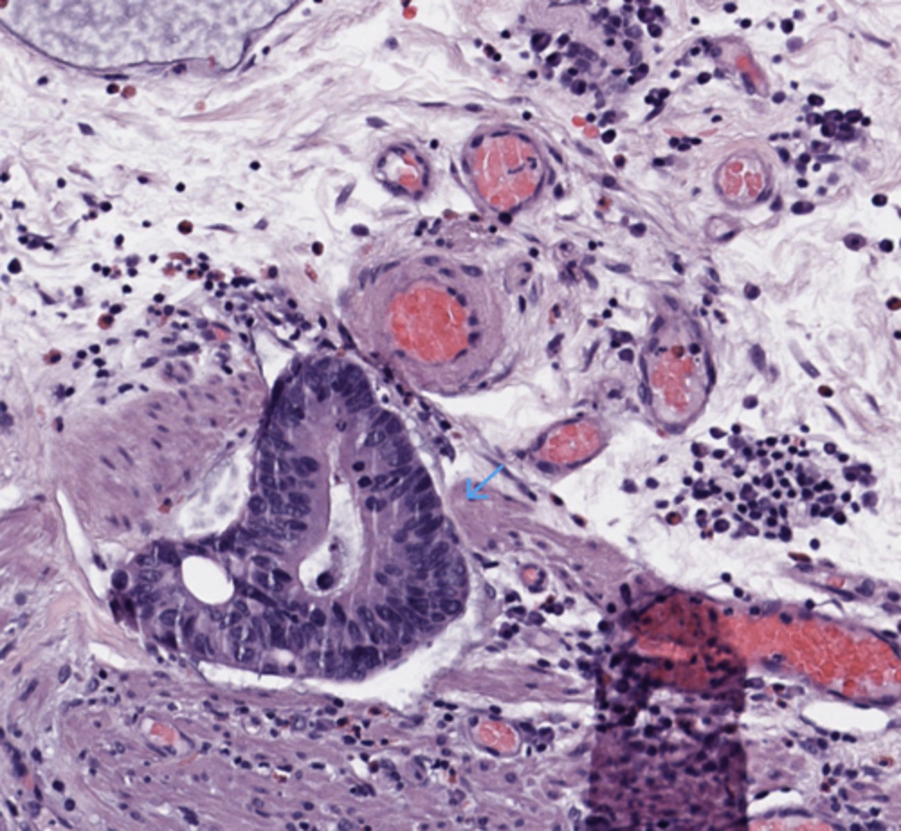<p>Stomach</p>