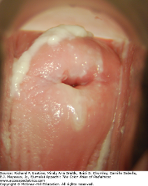 <p>What is this physical exam</p>