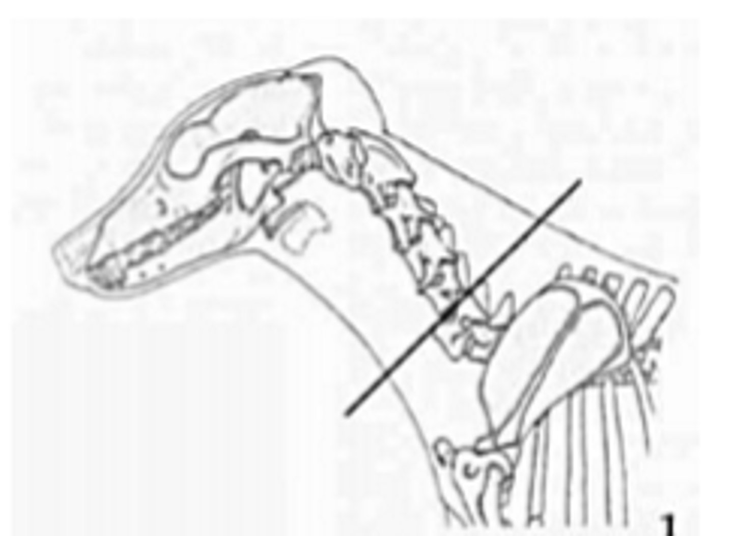 <p>cervical portion of the esophagus position</p>