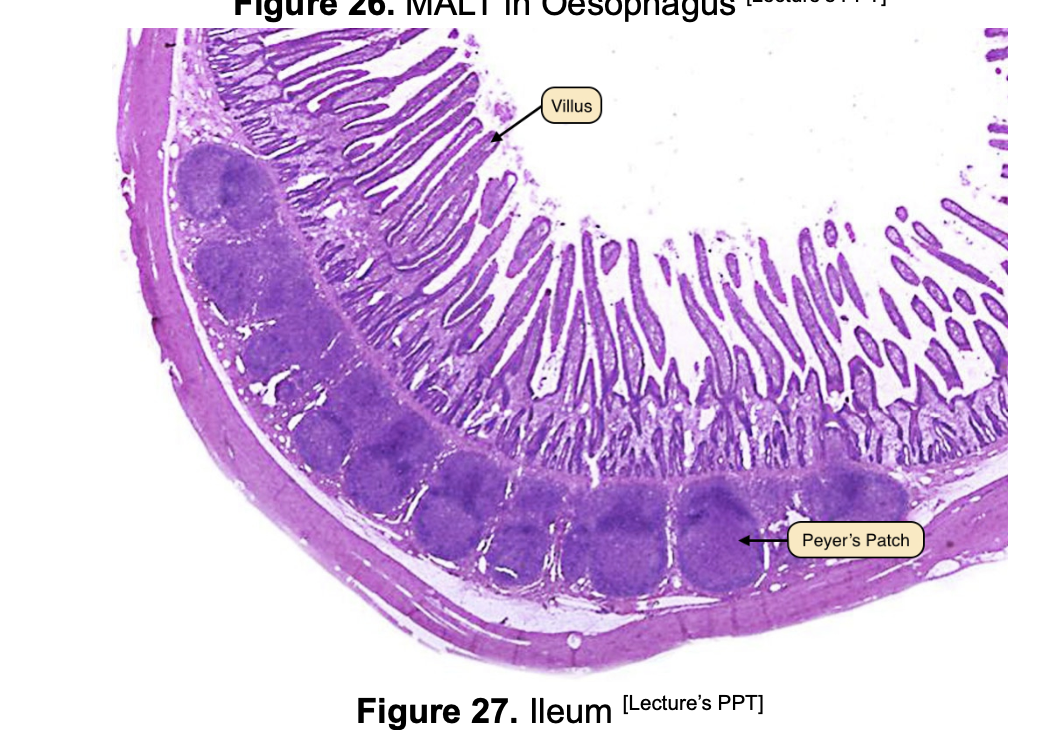 <p>Ileum only</p>