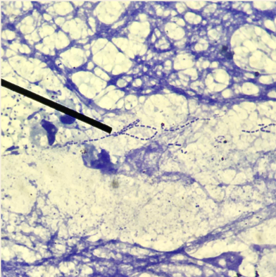 <p>The primary content in the cell wall of this organism is composed of what two (2) substances responsible for its appearance using gram staining test? (Indicate answers in alphabetical order using the first letter of the answer. Separate answers with a comma then a space. EXAMPLE: Answer A, Answer B</p>