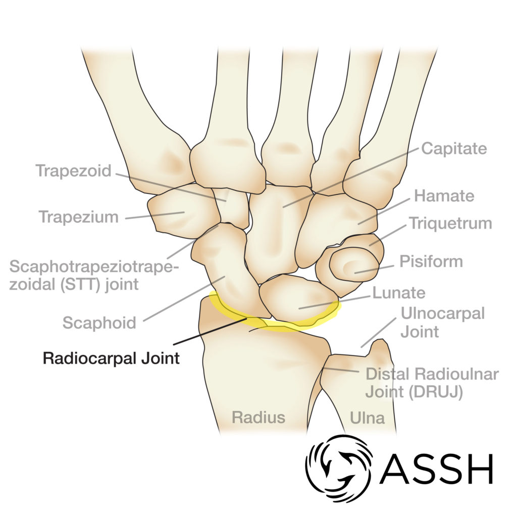 <p>In the <em>Radiocarpal </em>joint during radial deviation, the carpal bones are _____ , and the radius is _______, the carpal bones move ______. </p>