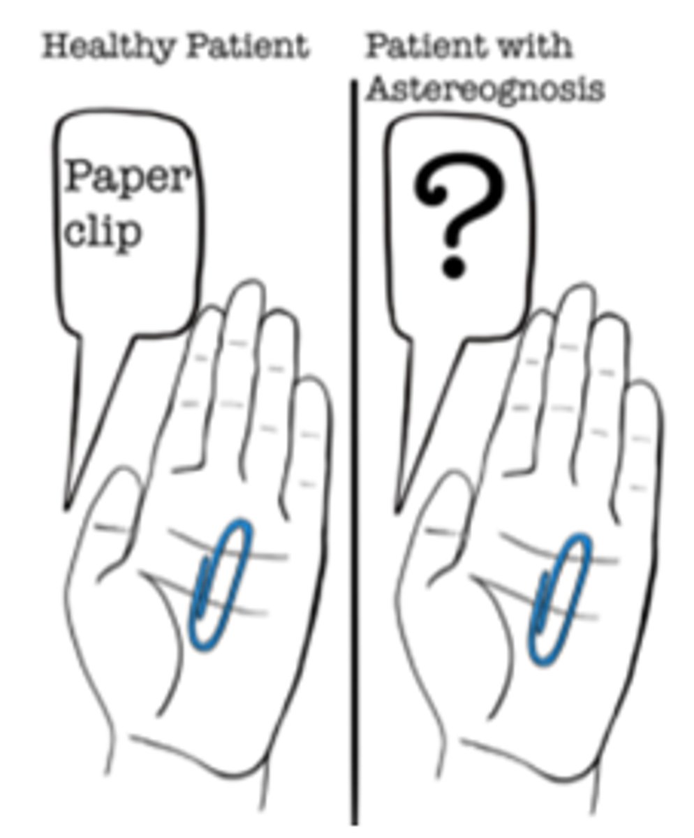 <p>inability to recognize objects by touch</p>