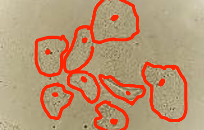 term image