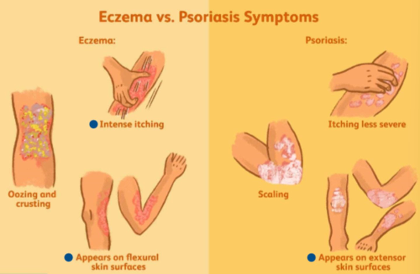 <p>- blepharitis (ezcema is most common in kids)</p>